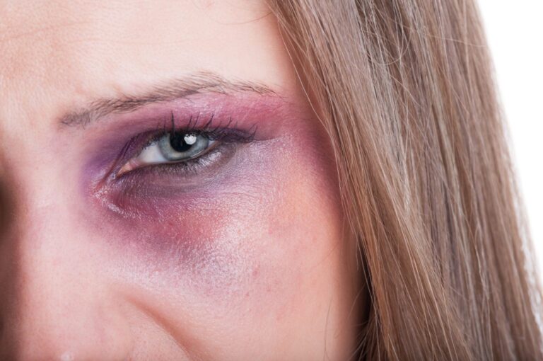 A cada 24 horas, ao menos oito mulheres são vítimas de violência