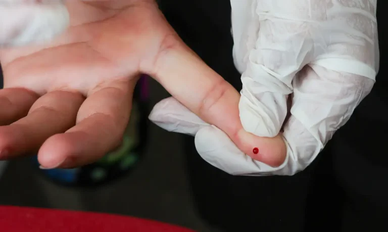 SUS passa a oferecer teste rápido de dengue